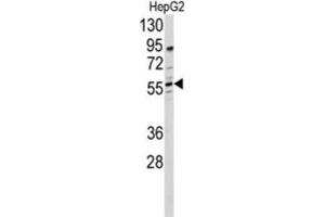 Western Blotting (WB) image for anti-24-Dehydrocholesterol Reductase (DHCR24) antibody (ABIN3001663) (Seladin 1 抗体)