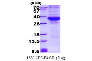 Image no. 1 for Cyclin-Dependent Kinase 4 (CDK4) protein (His tag) (ABIN1098680) (CDK4 Protein (His tag))