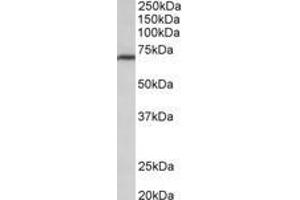 Image no. 1 for anti-Methylenetetrahydrofolate Reductase (NAD(P)H) (MTHFR) (AA 369-383) antibody (ABIN1103105) (MTHFR 抗体  (AA 369-383))