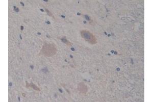 Immunohistochemistry (IHC) image for anti-Complement Component C7 (C7) (AA 1-144) antibody (ABIN7443419)