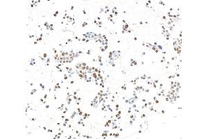Immunocytochemistry (ICC) image for anti-Zinc Finger CCCH-Type Containing 4 (ZC3H4) (AA 1050-1100) antibody (ABIN7795761)