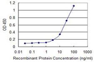 Detection limit for recombinant GST tagged RCN1 is 1 ng/ml as a capture antibody. (RCN1 抗体  (AA 31-331))