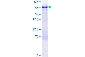 MTMR2 Protein (AA 1-571) (GST tag)