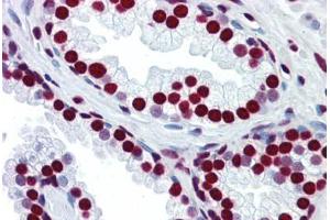 Human Prostate: Formalin-Fixed, Paraffin-Embedded (FFPE) (HNRNPM 抗体  (N-Term))