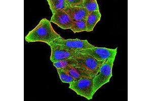 Immunocytochemistry (ICC) image for anti-PR Domain Containing 5 (PRDM5) (AA 1-100) antibody (ABIN5874500) (PRDM5 抗体  (AA 1-100))