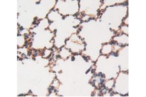 IHC-P analysis of Rat Lung Tissue, with DAB staining. (MMP12 抗体  (AA 20-99))