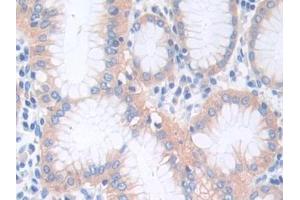 DAB staining on IHC-P; Samples: Human Stomach Tissue (CTNNA1 抗体  (AA 2-228))