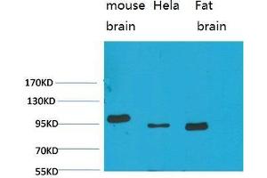 Western Blot (WB) analysis of 1)Mouse Brain Tissue, 2)HeLa, 3)Rat Brain Tissue with EphA1 Rabbit Polyclonal Antibody diluted at 1:2000. (EPHA1 抗体)