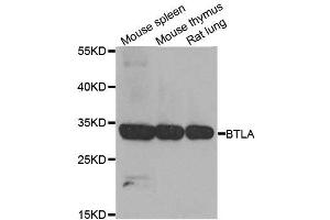 Western blot analysis of extracts of various cell lines, using BTLA antibody. (BTLA 抗体  (AA 31-241))