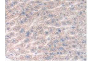 IHC-P analysis of Mouse Liver Tissue, with DAB staining. (DDX58 抗体  (AA 1-211))