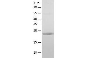 CSN2 Protein (AA 16-226) (His tag)