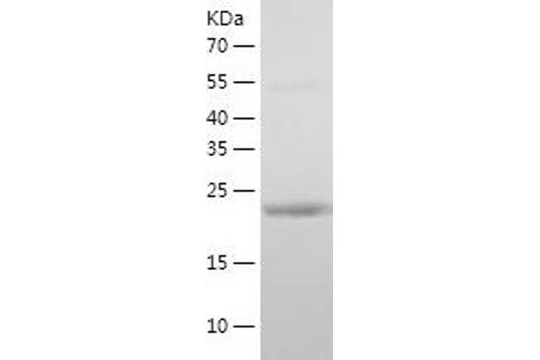 CSN2 Protein (AA 16-226) (His tag)