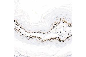 Immunohistochemistry (IHC) image for anti-Proliferating Cell Nuclear Antigen (PCNA) antibody (ABIN6139020)