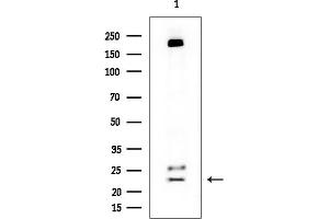 Western blot analysis of lysates from Rat brain, using GUCA1A Mouse Monoclonal Antibody at 1/1000 dilution. (GCAP1 抗体)