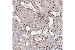 Immunohistochemical staining of human kidney with TBC1D12 polyclonal antibody  shows strong nucelar positivity in cells in tubules. (TBC1D12 抗体)