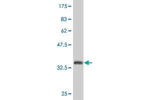 Western Blot detection against Immunogen (36. (SP1 抗体  (AA 522-618))