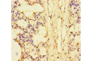 Immunohistochemistry of paraffin-embedded human lung tissue using ABIN7169732 at dilution of 1:100 (SMCO1 抗体  (AA 82-214))
