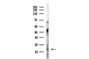 Western blot analysis of lysates from COLO205 cells(LPS, 4h treatment), using TNFRSF17 Antibody at 1/1000 dilution.