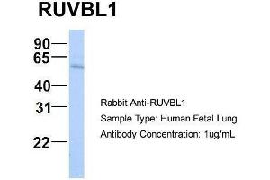 Host:  Rabbit  Target Name:  RUVBL1  Sample Type:  Human Fetal Lung  Antibody Dilution:  1. (RUVBL1 抗体  (N-Term))