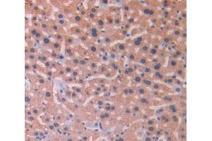 IHC-P analysis of liver tissue, with DAB staining. (IL18RAP 抗体  (AA 396-548))