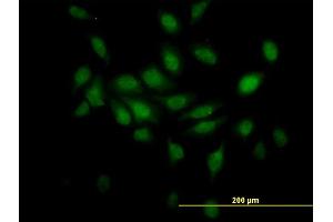 Immunofluorescence (IF) image for anti-Transcription Elongation Factor B (SIII), Polypeptide 2 (18kDa, Elongin B) (TCEB2) (AA 9-118) antibody (ABIN563104)
