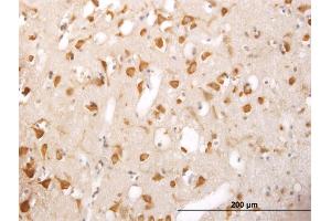 Immunoperoxidase of monoclonal antibody to TRIM25 on formalin-fixed paraffin-embedded human cerebral cortex. (TRIM25 抗体  (AA 211-310))