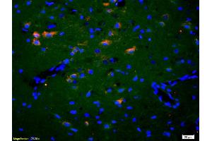 Formalin-fixed and paraffin-embedded rat brain labeled with Anti-EphA2/Eph receptor A2 Polyclonal Antibody, Unconjugated (ABIN669201) 1:200, overnight at 4°C, The secondary antibody was Goat Anti-Rabbit IgG, Cy3 conjugated used at 1:200 dilution for 40 minutes at 37°C. (EPH Receptor A2 抗体  (AA 901-976))