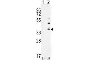 Western blot analysis of TNFSF15 (arrow) using rabbit polyclonal TNFSF15 Antibody (Center) . (TNFSF15 抗体  (Middle Region))