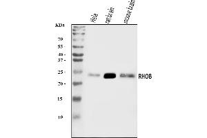 Western blot analysis of RHOB using anti-RHOB antibody (ABIN7599782).
