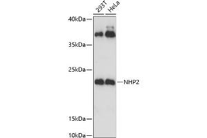 Western blot analysis of extracts of various cell lines, using NHP2 Antibody (ABIN6133224, ABIN6144622, ABIN6144623 and ABIN6221656) at 1:3000 dilution. (NHP2 抗体  (AA 1-153))