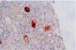Immunohistochemistry of paraffin-embedded sections (kidney) Immunohistochemistry staining of kidney allograft biopsy (paraffin-embedded sections) with anti-human HLA-G (MEM-G/2). (HLAG 抗体)