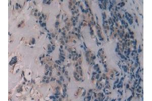 Immunohistochemistry (IHC) image for anti-Alanine Aminotransferase (ALT) (AA 147-263) antibody (ABIN7438472)