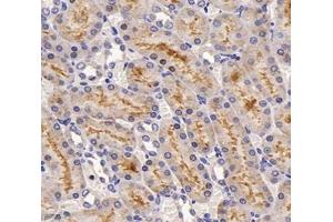 Immunohistochemistry (Paraffin-embedded Sections) (IHC (p)) image for anti-Solute Carrier Family 22 (Organic Cation Transporter), Member 1 (SLC22A1) antibody (ABIN7075663)