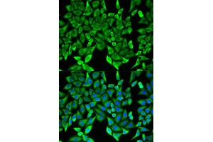 Immunofluorescence analysis of HeLa cells using MOG antibody. (MOG 抗体)