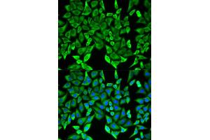 Immunofluorescence analysis of HeLa cells using MOG antibody. (MOG 抗体)