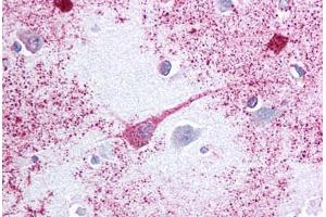 Immunohistochemistry (IHC) image for anti-Prostaglandin E Receptor 3 (Subtype EP3) (PTGER3) (Cytoplasmic Domain) antibody (ABIN1049255)