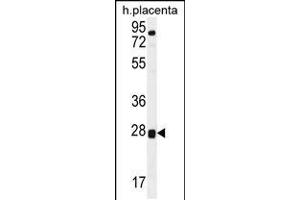 Western blot analysis in human placenta tissue lysates (35ug/lane). (TOR2A 抗体  (AA 194-221))