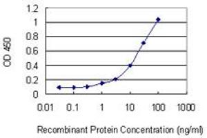 Detection limit for recombinant GST tagged MYO3B is 0. (MYO3B 抗体  (AA 280-369))