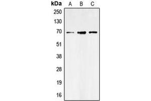 Western blot analysis of GAT1 expression in SHSY5Y (A), NIH3T3 (B), rat brain (C) whole cell lysates. (SLC6A1 抗体  (Center))