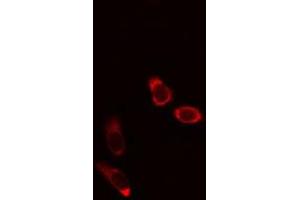 ABIN6275977 staining Hela cells by IF/ICC. (CCZ1B 抗体)