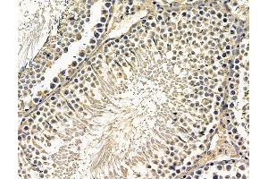 ABIN7096656 and ABIN7100721 at 1/100 staining rat testis tissue by IHC-P. (CHRND 抗体)