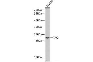 Western blot analysis of extracts of SW620 cells using TAC1 Polyclonal Antibody at dilution of 1:1000. (TAC1 抗体)