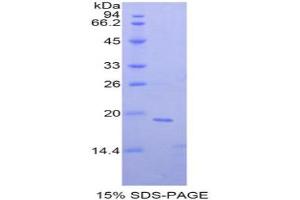 SDS-PAGE analysis of Mouse NME4 Protein. (Non Metastatic Cells 4, Protein NM23A Expressed In 蛋白)