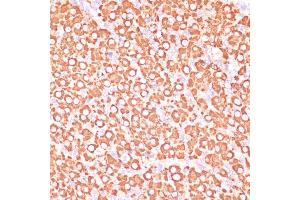 Immunohistochemistry of paraffin-embedded rat ovary using MEK3 antibody (ABIN6130544, ABIN6143484, ABIN6143485 and ABIN6223650) at dilution of 1:100 (40x lens). (MAP2K3 抗体  (AA 1-170))