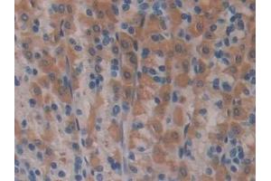 Immunohistochemistry (IHC) image for anti-Nitric Oxide Synthase 2, Inducible (NOS2) (AA 518-694) antibody (ABIN7432718)