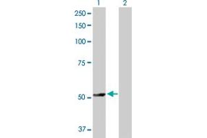 Western Blot analysis of TRAF4 expression in transfected 293T cell line by TRAF4 MaxPab polyclonal antibody. (TRAF4 抗体  (AA 1-470))