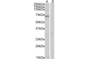 ABIN185248 (0. (FOXO3 抗体  (C-Term))