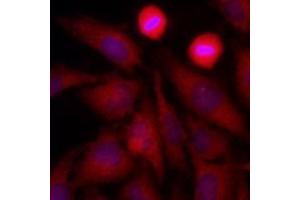 Immunofluorescenitrocellulosee of human HeLa cells stained with Hoechst 3342 (Blue) for nucleus staining and monoclonal anti-human GAPDH antibody (1:500) with Texas Red (Red). (GAPDH 抗体  (AA 1-335))