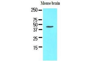 The extracts of mouse brain (50ug) were resolved by SDS-PAGE, transferred to NC membrane and probed with anti-human Homer1 (1:1000). (HOMER1 抗体)