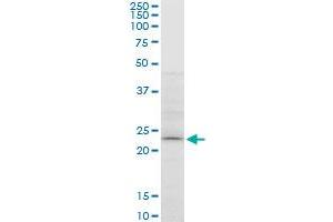 ATG5 monoclonal antibody (M05), clone 1E7. (ATG5 抗体  (AA 176-275))